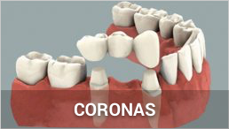 Coronas