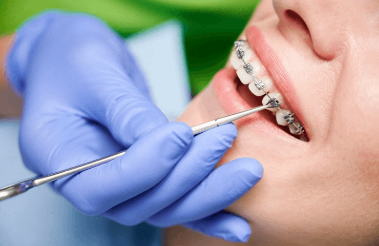 ortodoncia paredes dental bahia blanca 1
