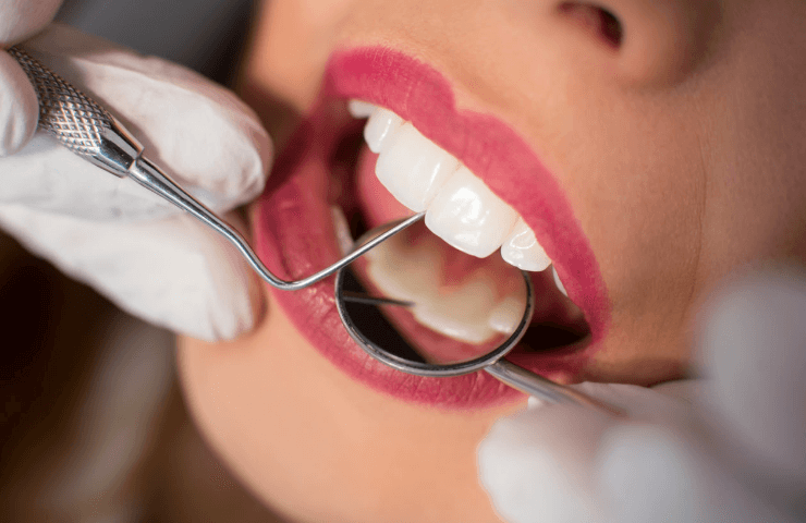 tratamiento de conducto paredes dental 01