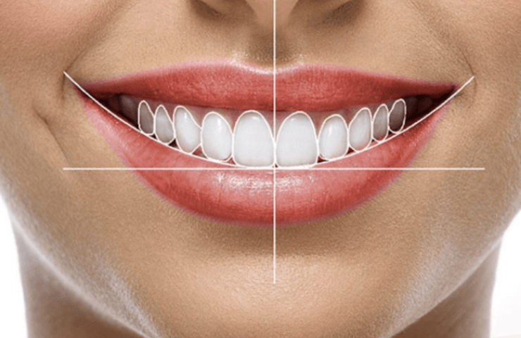 sonrisas hermosas dentista paredes dental – 1